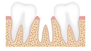 Missing tooth animation
