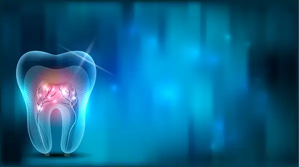 Abstract illustration of a tooth showing nerve inflammation, representing root canal treatment.