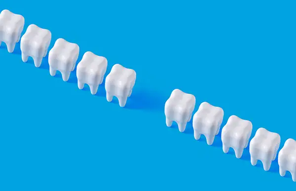 Two rows of tooth models with a single tooth missing, emphasizing the concept of tooth loss.